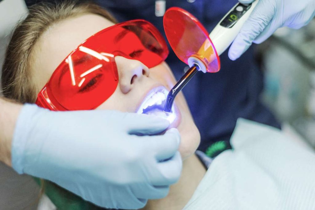 Odontoiatria Conservativa - Studio Dentistico Cacciamani - odontoiatria conservativa ed endodonzia