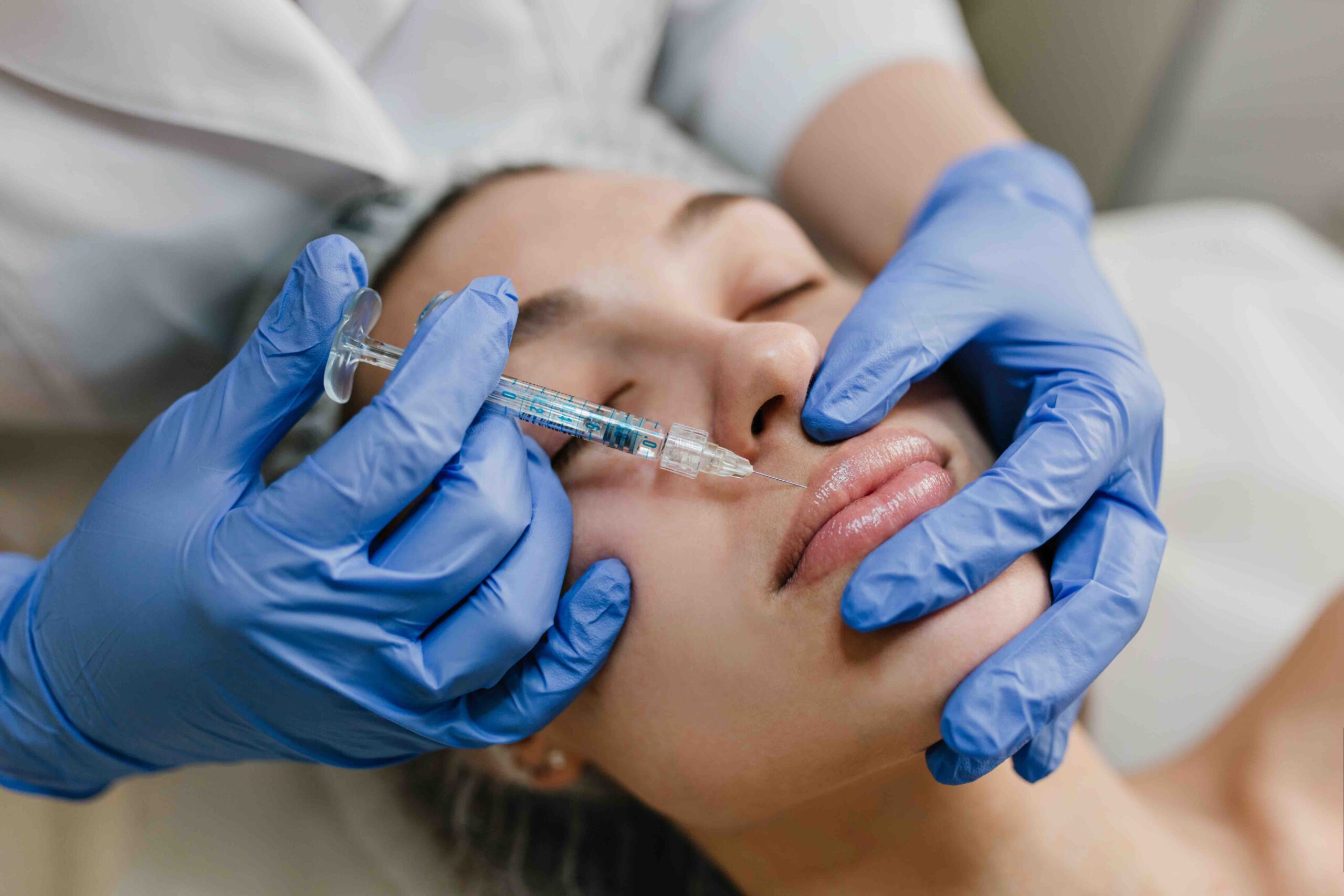 Come far durare di più il filler labbra